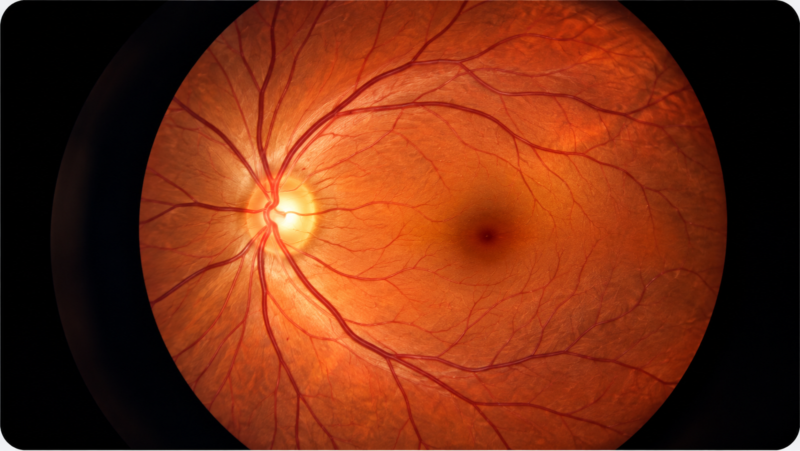 Retina